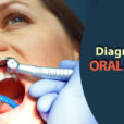 diagnosis of oral cancer