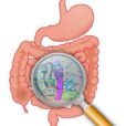 gastrointestinal stromal tumors in hindi