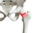 Low ExpertBoneHealthFig2