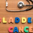 bladder cancer 640x480