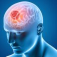 understanding brain tumours 1280x720