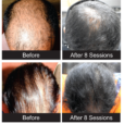 Before After images