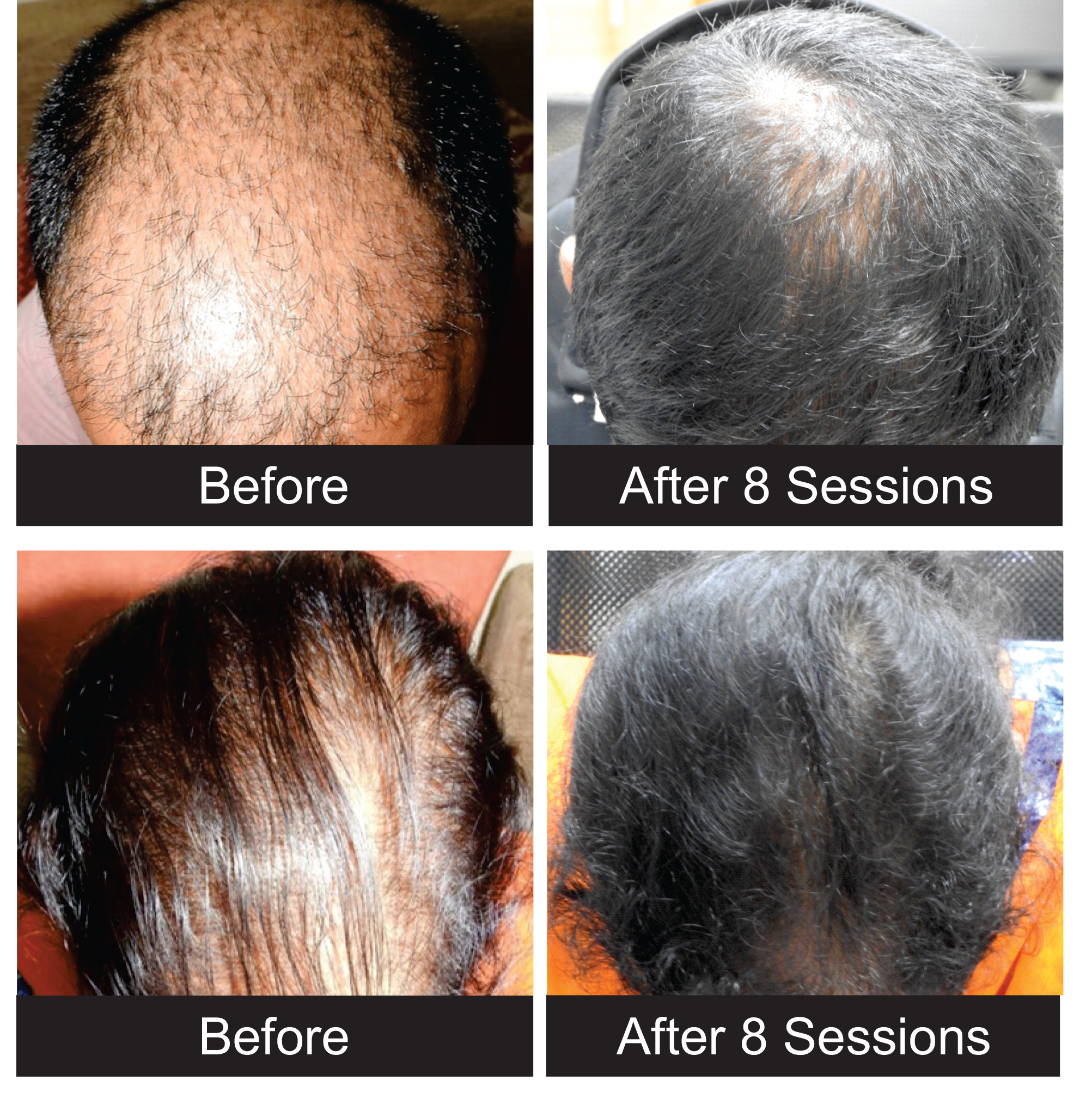 Before After images