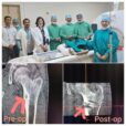CT Orthopedic Procedure