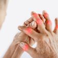 Early Detection Screening for Rheumatoid Arthritis.jpg.optimal