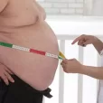 obesity