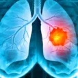 ADAURA Phase III trial