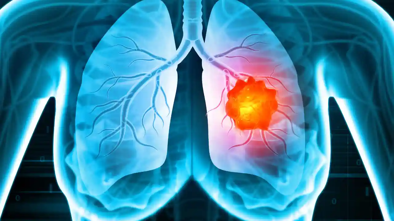 ADAURA Phase III trial