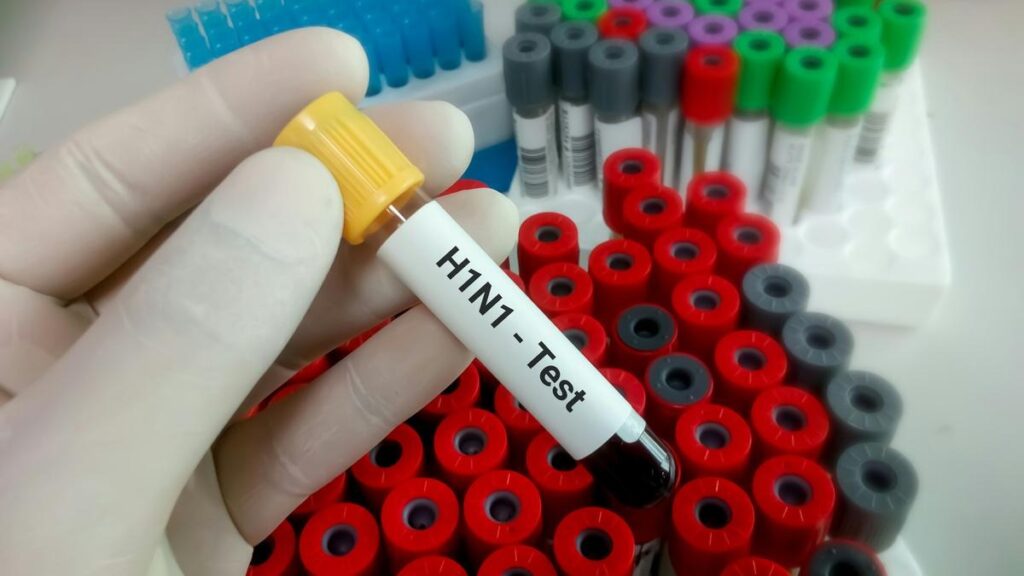 H1N1 flu test blood sample tube in a laboratory with medical test tubes