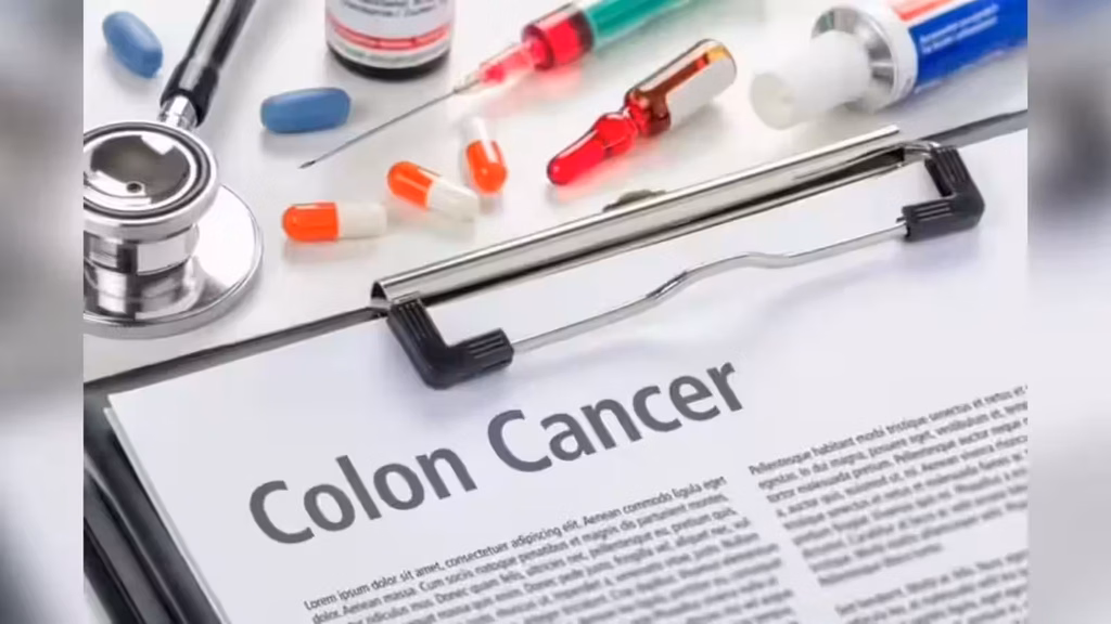Colorectal Cancer Rates Rise Across US Adults; Kidney Cancer Drug Combination Shows Survival Benefits 1 Colorectal Cancer